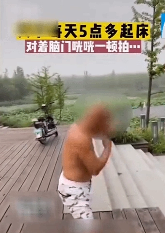 老人为了养生每天拍头二百次，经医生检查发现颅内出血