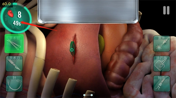 医院手术时间汉化版图3