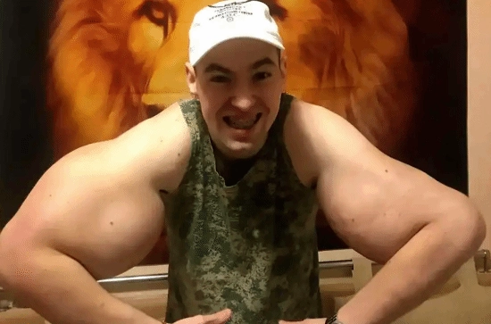 “俄罗斯‘大力水手’为增大肱二头肌注射凡士林，恐因感染面临双臂截肢风险”
