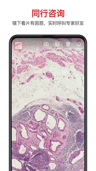 爱病理手机版图5
