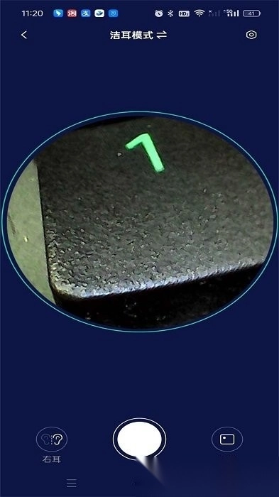 iSEE可视耳勺免费原版图2