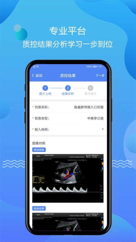 超声智库图2