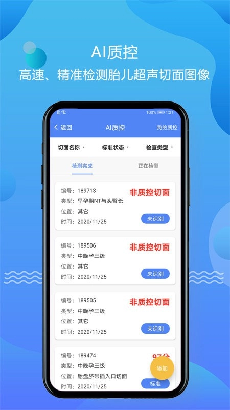 超声智库图3