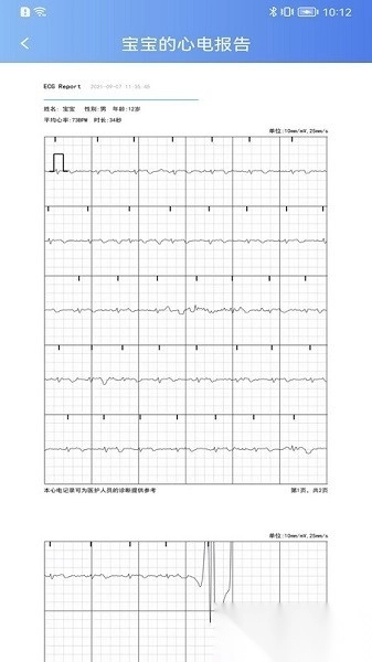 卡帕奇心电最新免费版图2