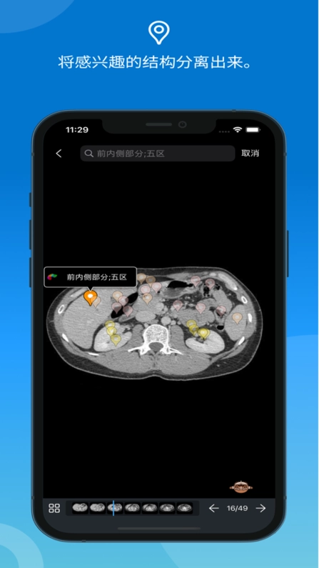 e-anatomy软件图1