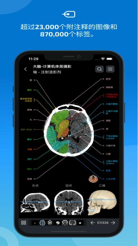 e-anatomy软件图4