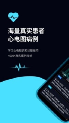 心电图ECG原版图1