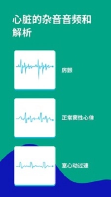 心电图ECG原版图3
