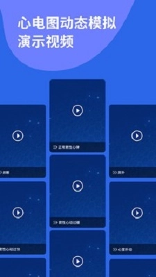 心电图ECG原版图2