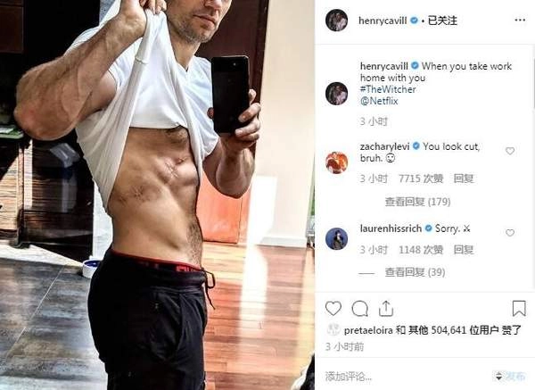 大超分享《巫师》真人剧杰洛特伤疤照网友打趣：是否安排了"床戏"?