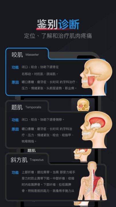 肌肉激痛点图谱手机版图3