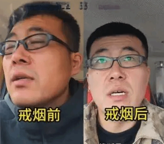 拥有22年烟龄的老烟民，坚持戒烟92天后的前后变化：差异显著