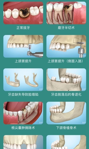 口腔图谱直装版图5