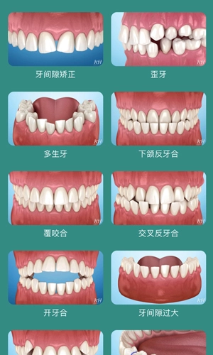 口腔图谱直装版图4
