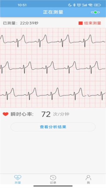 数维康心电官方最新版图2