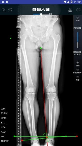 截骨大师安卓免费版图3