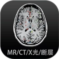 影像解剖图谱官方正版v4.3.1