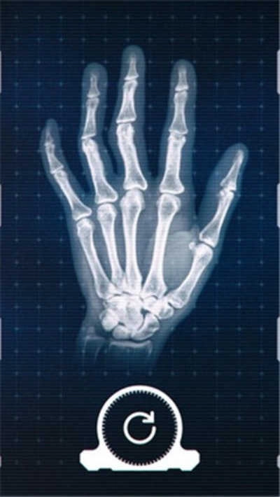 真实x射线模拟器手游无广告版图1