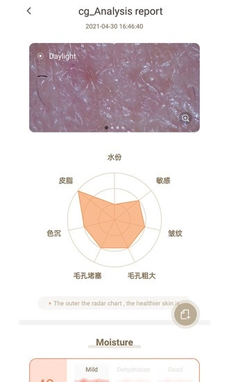 MoreMe水肤镜原版图3