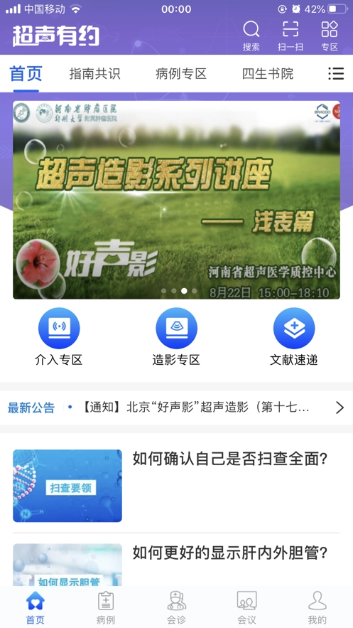 超声有约原版图1