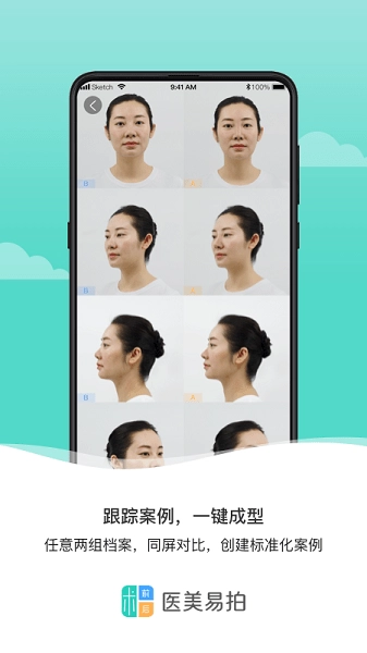 医美易拍安卓免费版图2