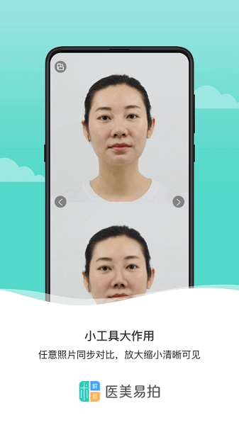医美易拍安卓免费版图3