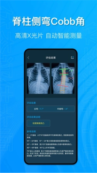 体态评估大师手机免费版图3