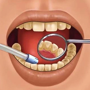 专治强迫症免费版