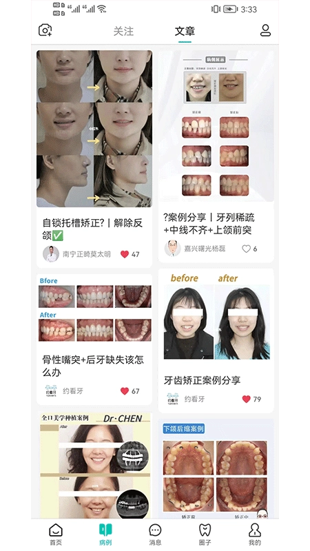 尚牙圈直装版图3