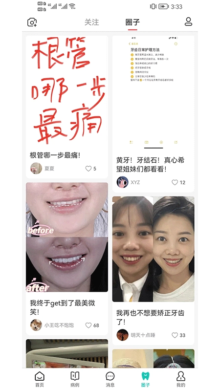 尚牙圈直装版图4