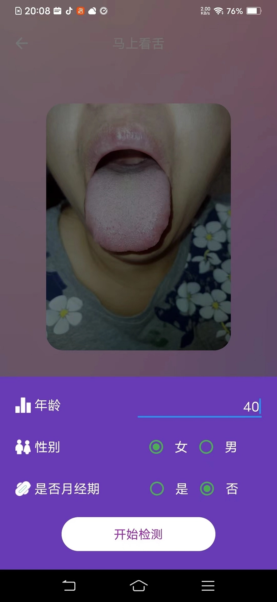 AI看舌最新版图1