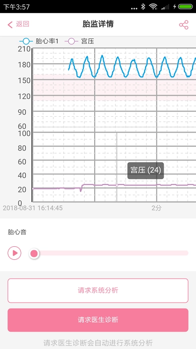 韵宝宝孕妇端官方最新版图1