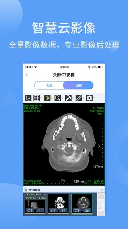 指云端医疗最新免费版