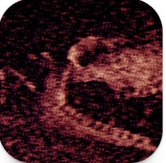 钢铁之肺(铁肺)游戏官方最新版