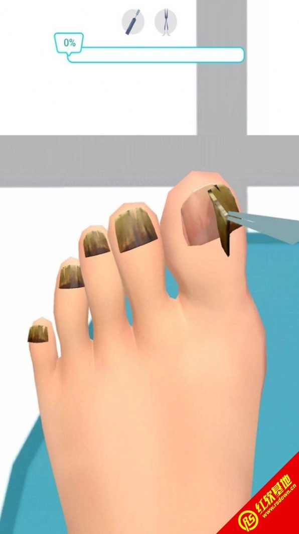 足部诊所模拟(3)