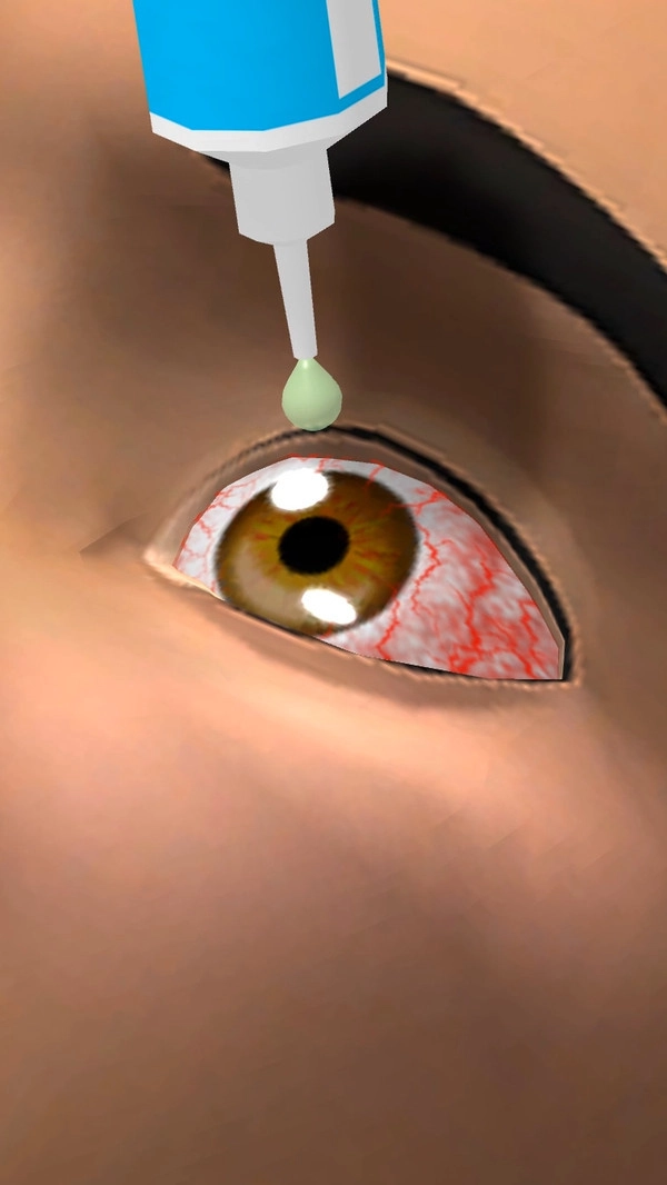 眼科医生安卓直装版(2)