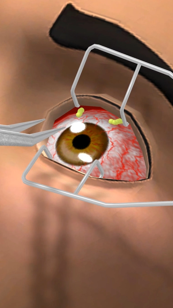 眼科医生安卓直装版(1)