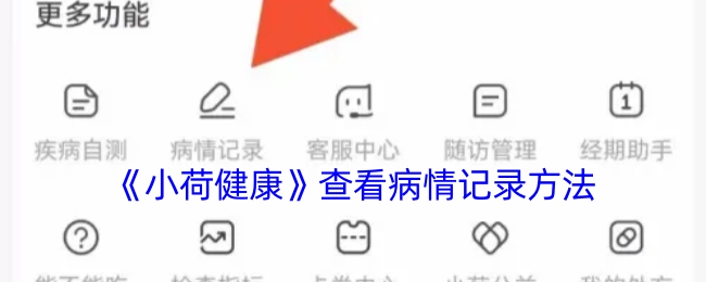 查看《小荷健康》病情记录的方法