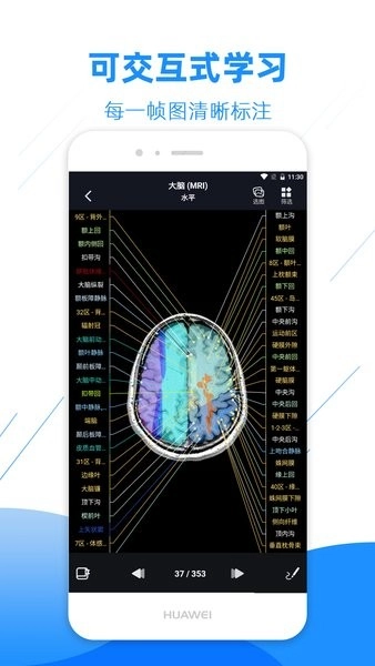 影像解剖图谱图1