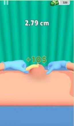 挤疙瘩挑战(Pimple Squeeze)图1