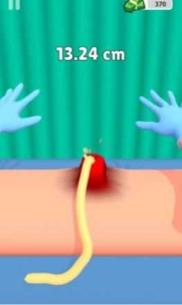 挤疙瘩挑战(Pimple Squeeze)图3