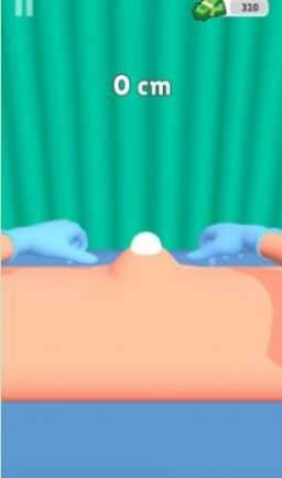 挤疙瘩挑战(Pimple Squeeze)图2