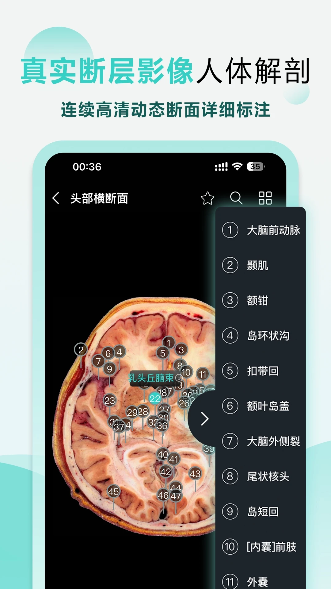 掌上3d解剖软件安卓版图1