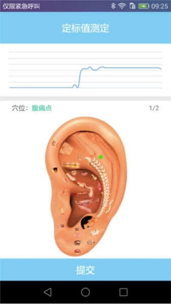 妙郎中耳穴检测图3
