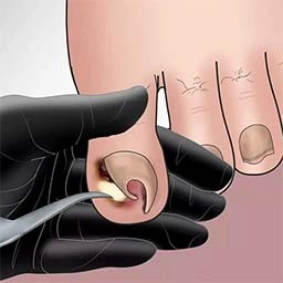 清洁SPA解压 V1.0