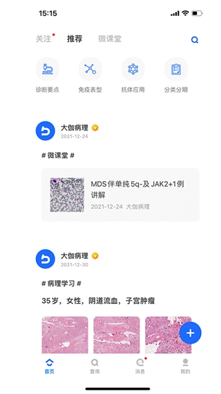 大伽病理图4