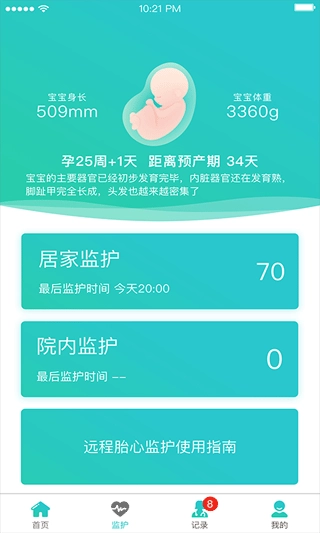 胎心监护图4