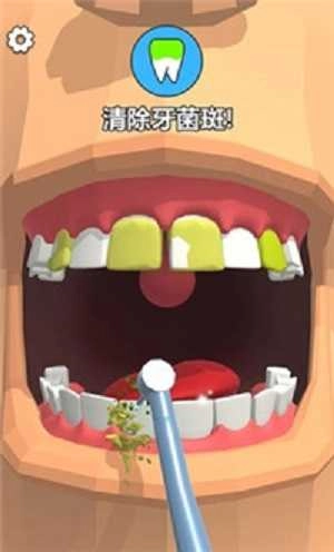 洗牙图2