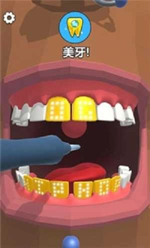 洗牙图3