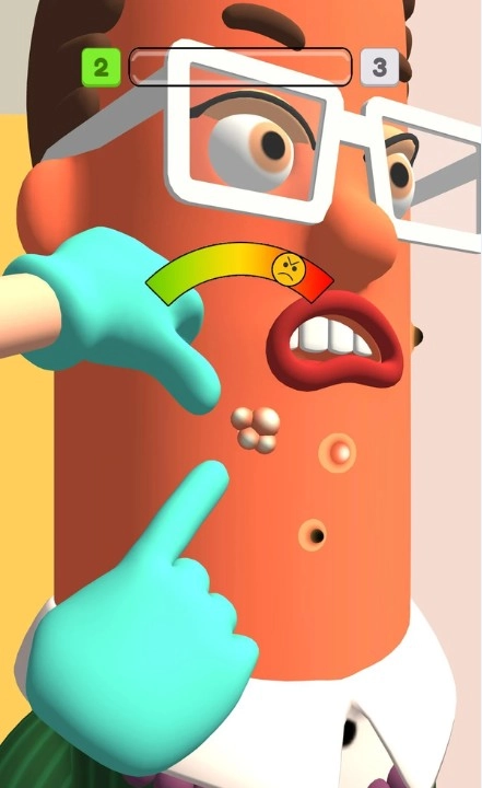 挤痘痘医生游戏安卓版